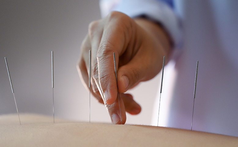 How To Recognize Your Body’s Need For Acupuncture And Respond